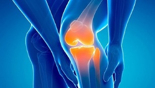 Artrosi del ginocchio