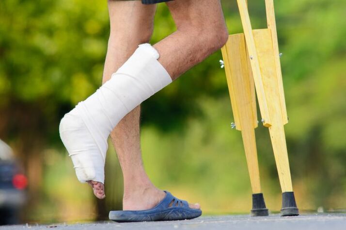 Lesioni alla caviglia come causa di osteoartrosi
