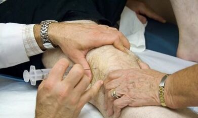 Come distinguere l'artrite dall'osteoartrosi