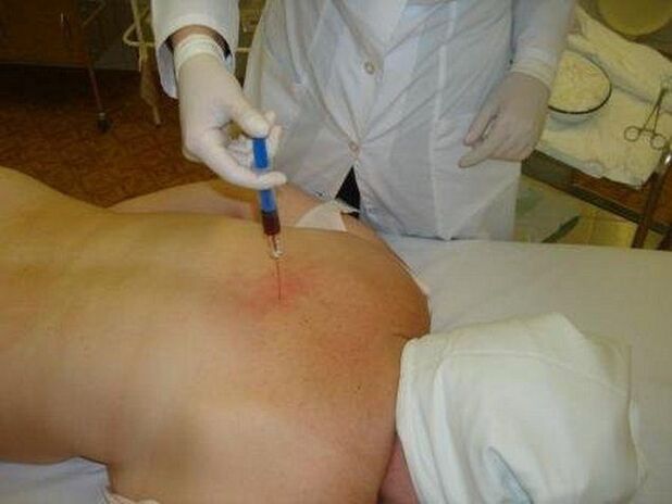 Preparazioni per l'osteocondrosi